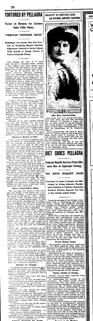 other Newspaper clipping from Nov 7, 1915 5696007